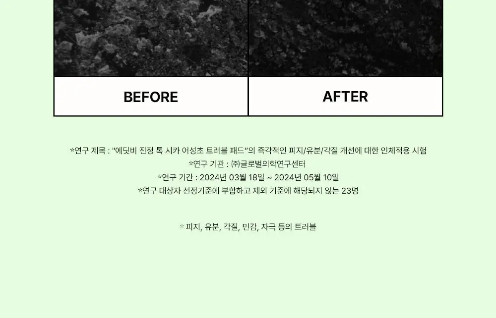 [쿨링진정/찢어쓰는패드] 에딧비 진정 톡 시카 어성초 트러블 패드 70매 상세페이지 27
